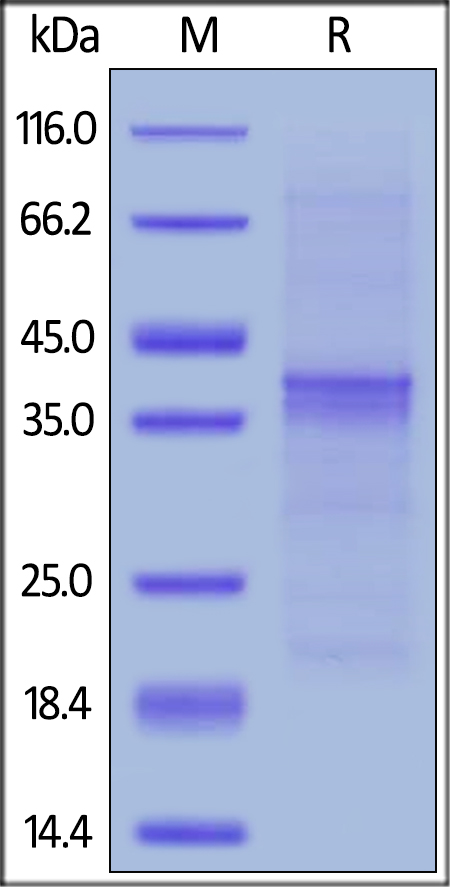 Human CD20 Full Length, His Tag, insect cell on SDS-PAGE under reducing (R) condition. The gel was stained overnight with Coomassie Blue. The purity of the protein is greater than 80%.